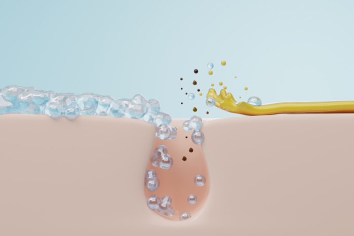 Acne Rescue Serum cleaning image